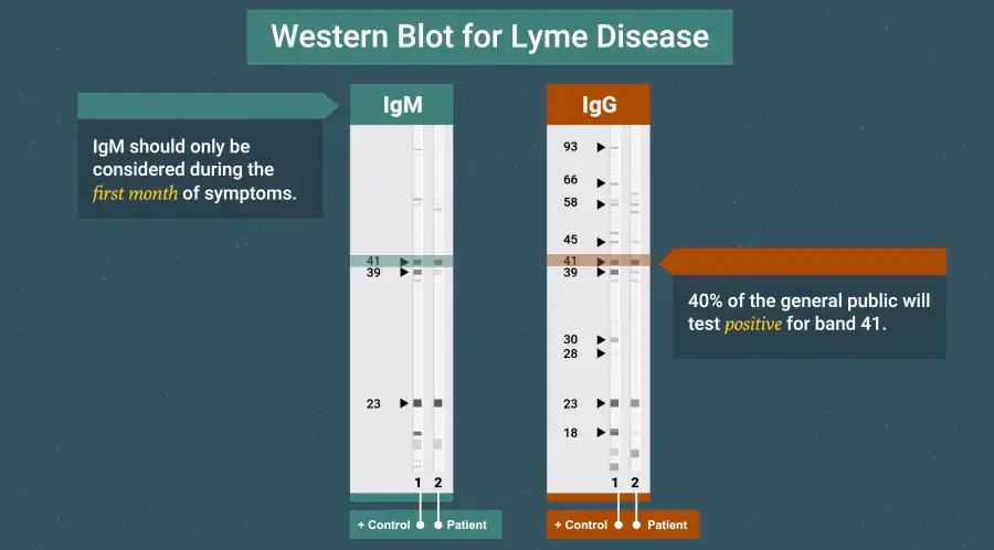 Graphic explaining the Western blot test